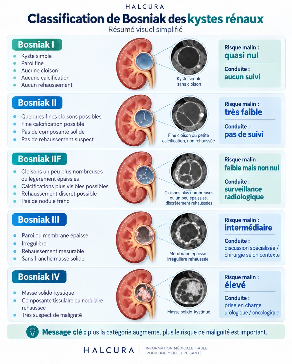 Imagerie médicale illustrant un kyste rénal et la classification de Bosniak